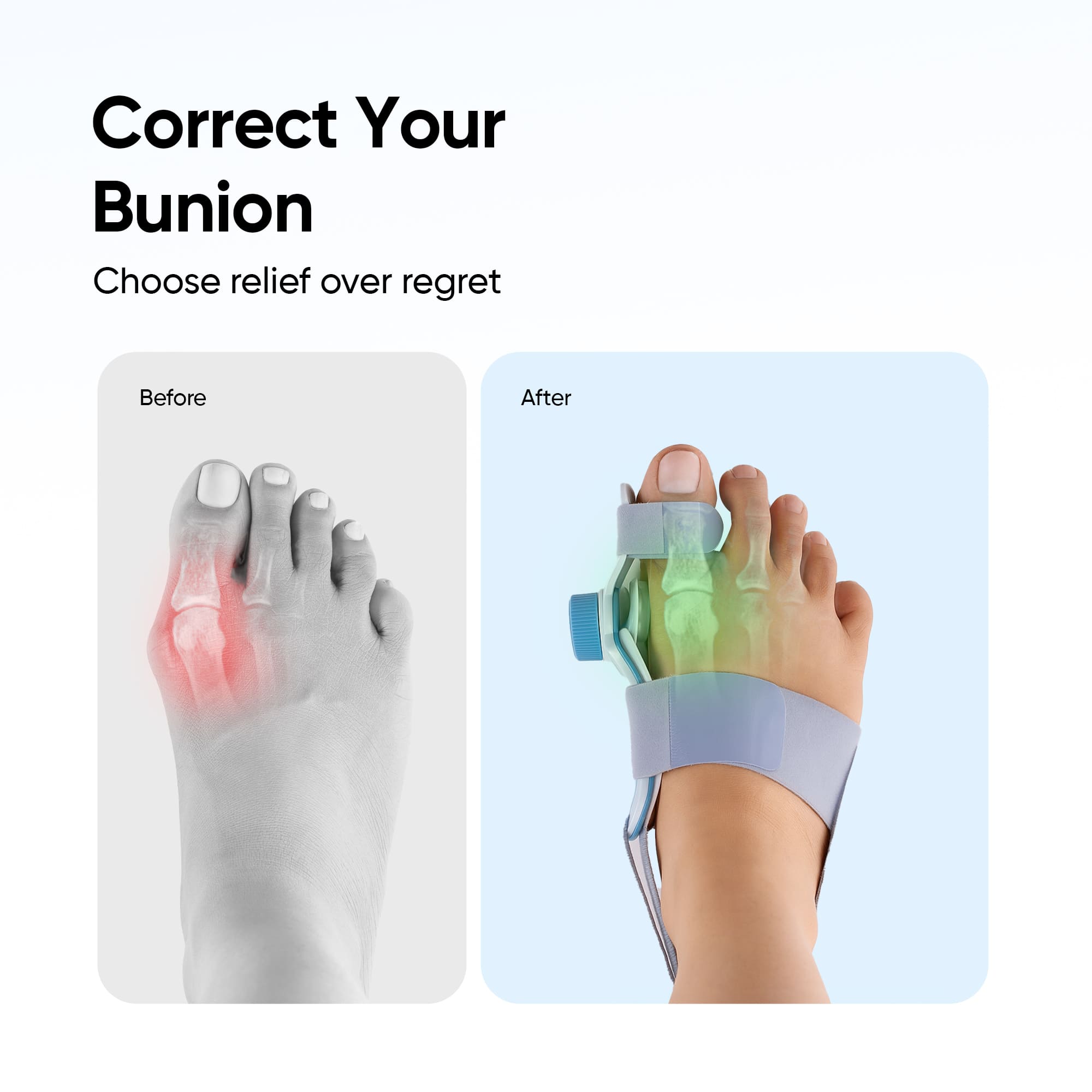 Bunion Corrector