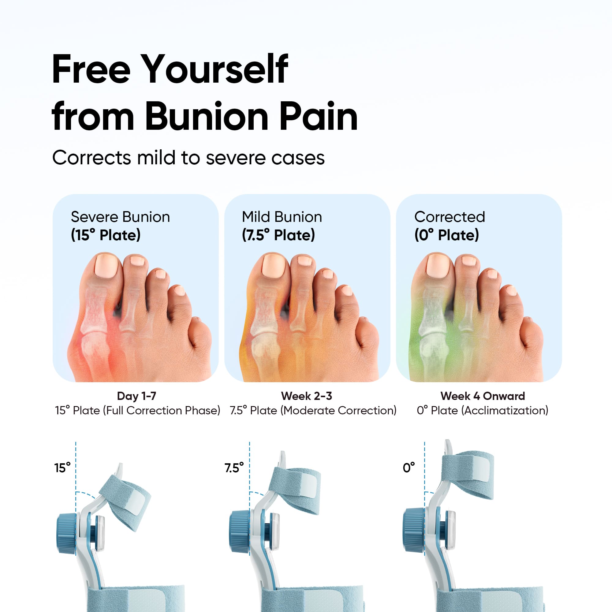 Bunion Corrector